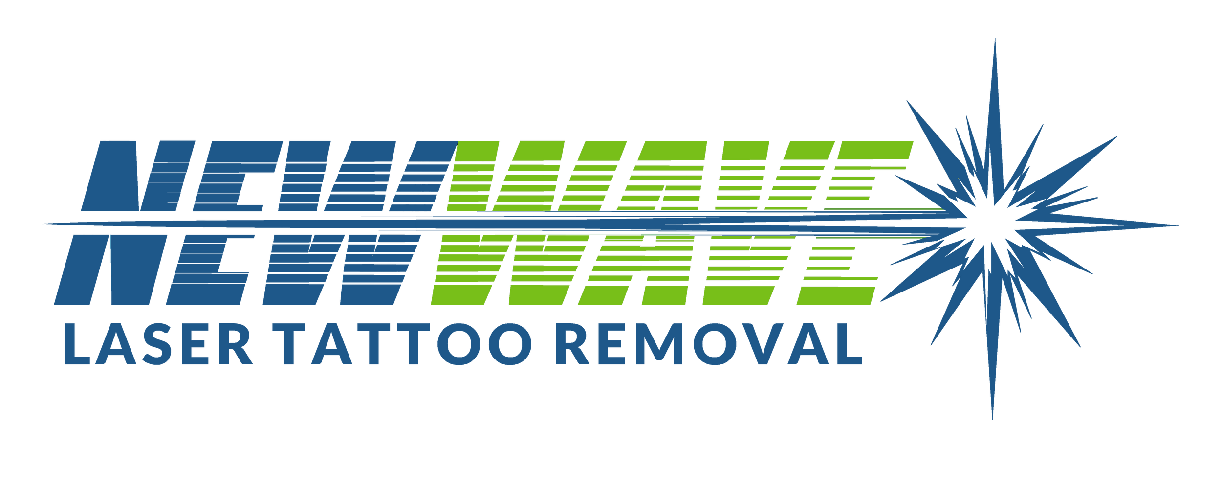 New Wave Laser Tattoo Removal
