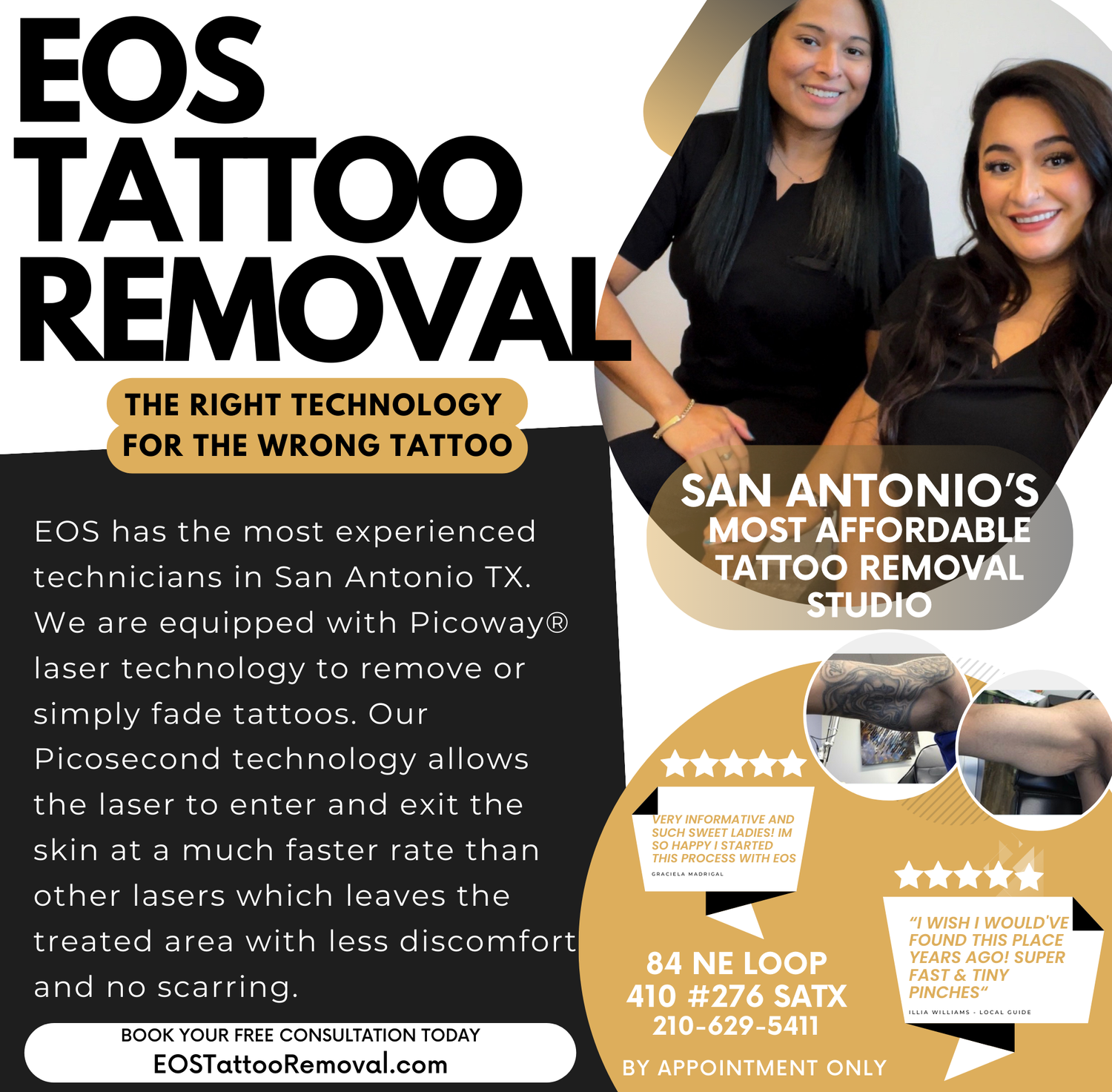 EOS Tattoo Removal