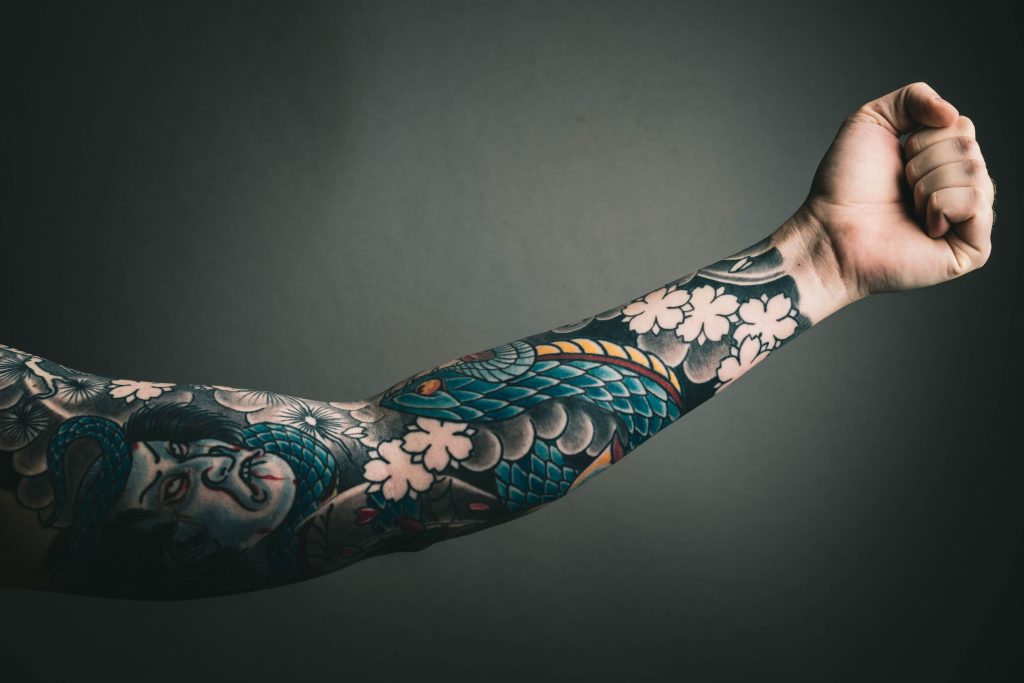 Legendary Laser Tattoo Removal