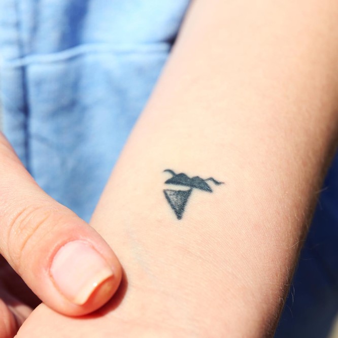 NewSkin Laser Tattoo Removal