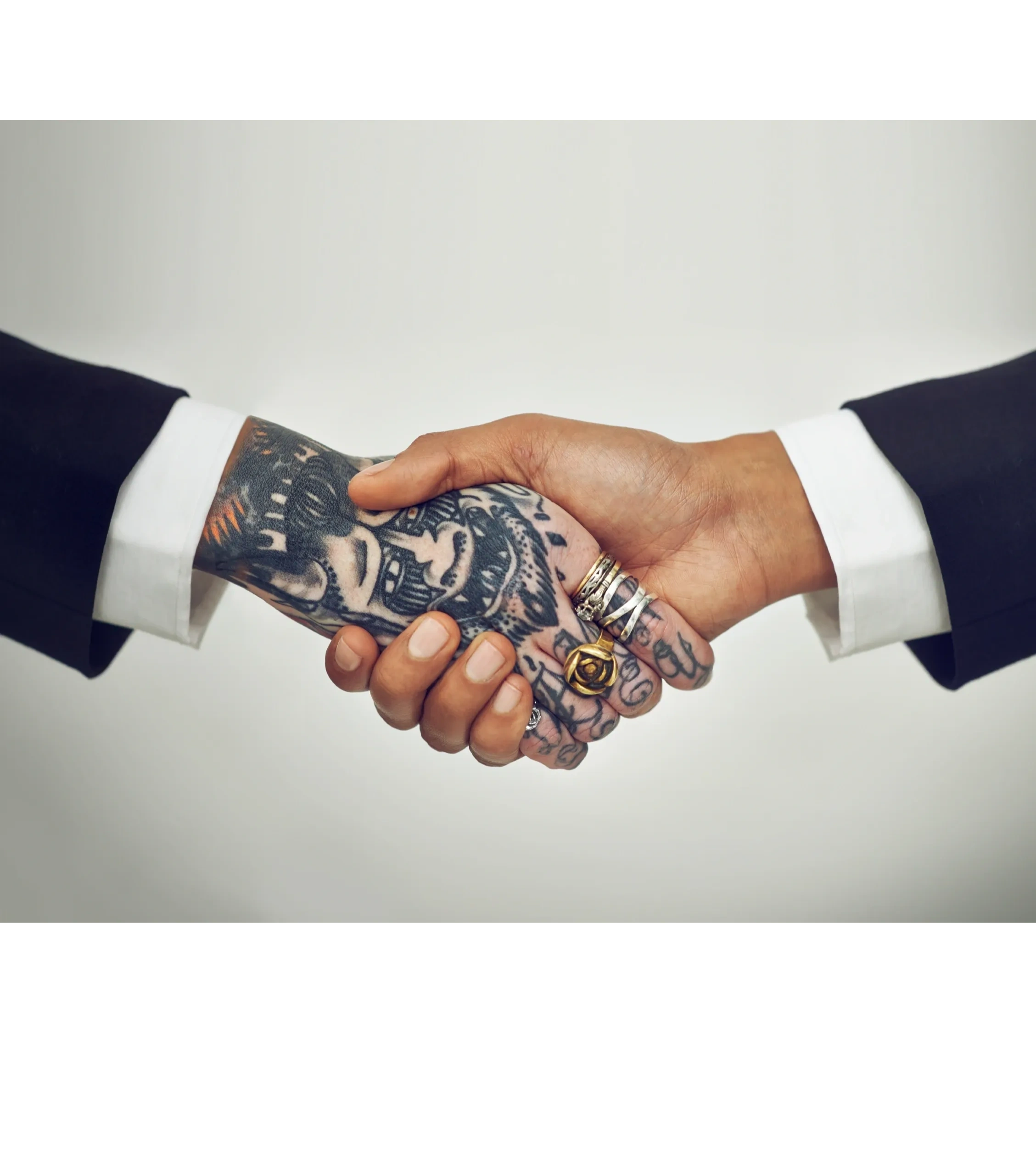 Dallas Laser Tattoo Removal