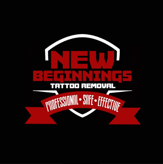 New Beginnings Tattoo Removal