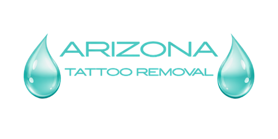 Arizona Tattoo Removal